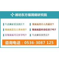 濰坊看銀屑病?？漆t(yī)院哪里專業(yè)