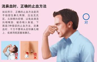 流鼻血怎么能快速止血，鼻出血的正確止血方法